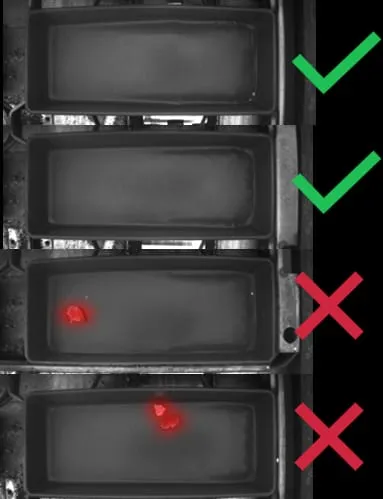 AI recognizes anomalies